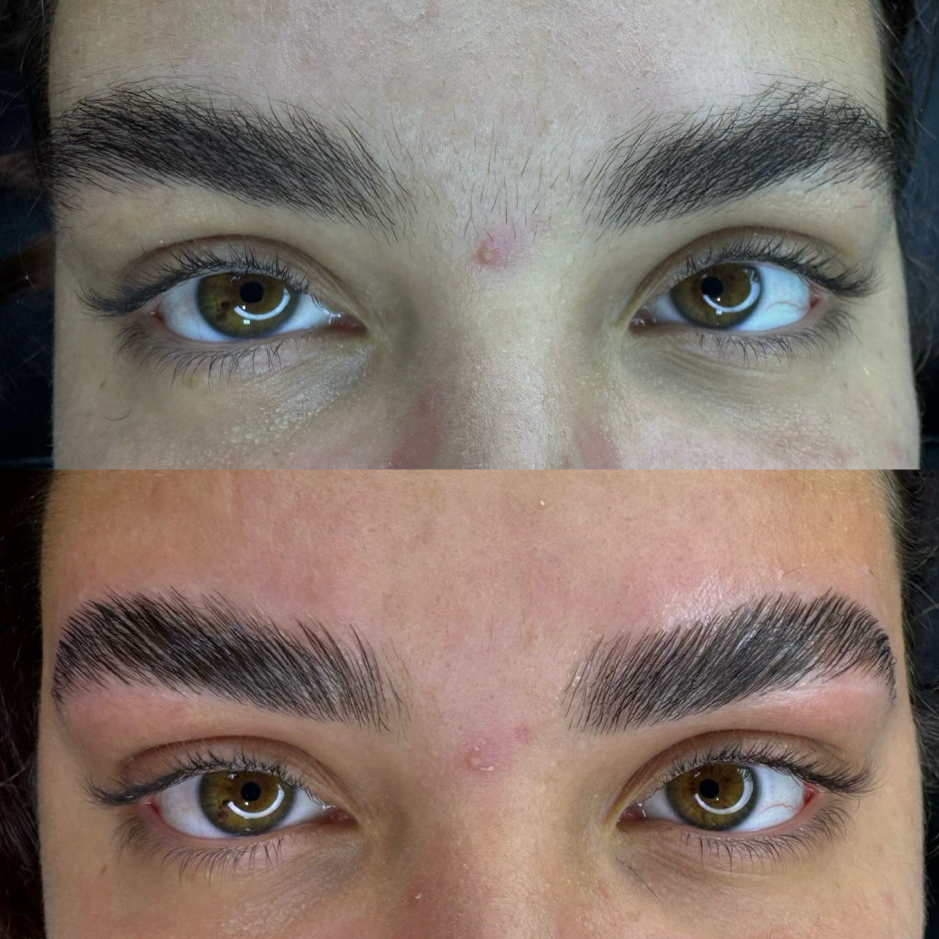 Resultado de tratamento - Antes e Depois